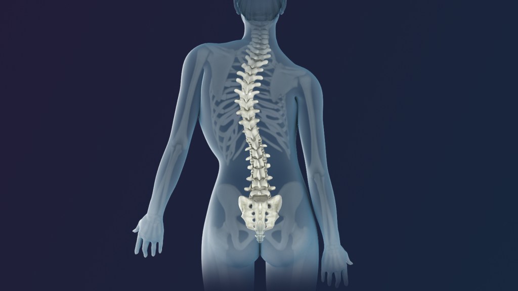 Scoliosis Treatment Without Surgery: How Physical Therapy Can&nbsp;Help